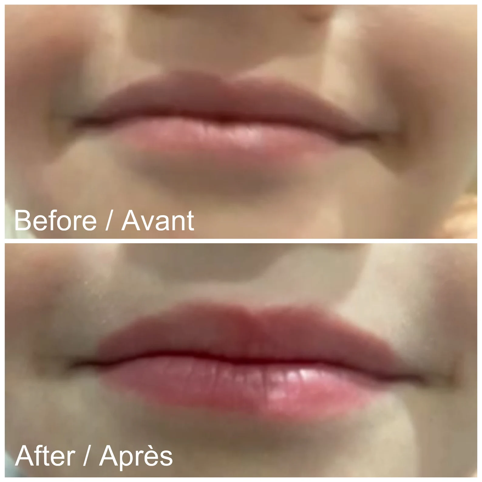 Lip Plumper gloss repulpant 🫦 – Image 9